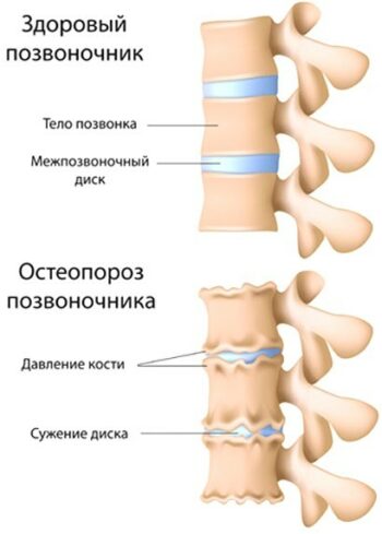 Факторы риска